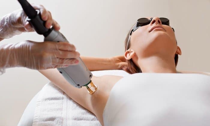 Laser Hair Removal
