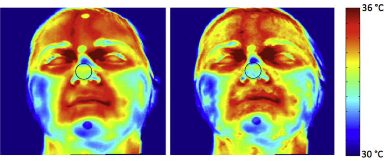 Photos of the face showing therrmal images